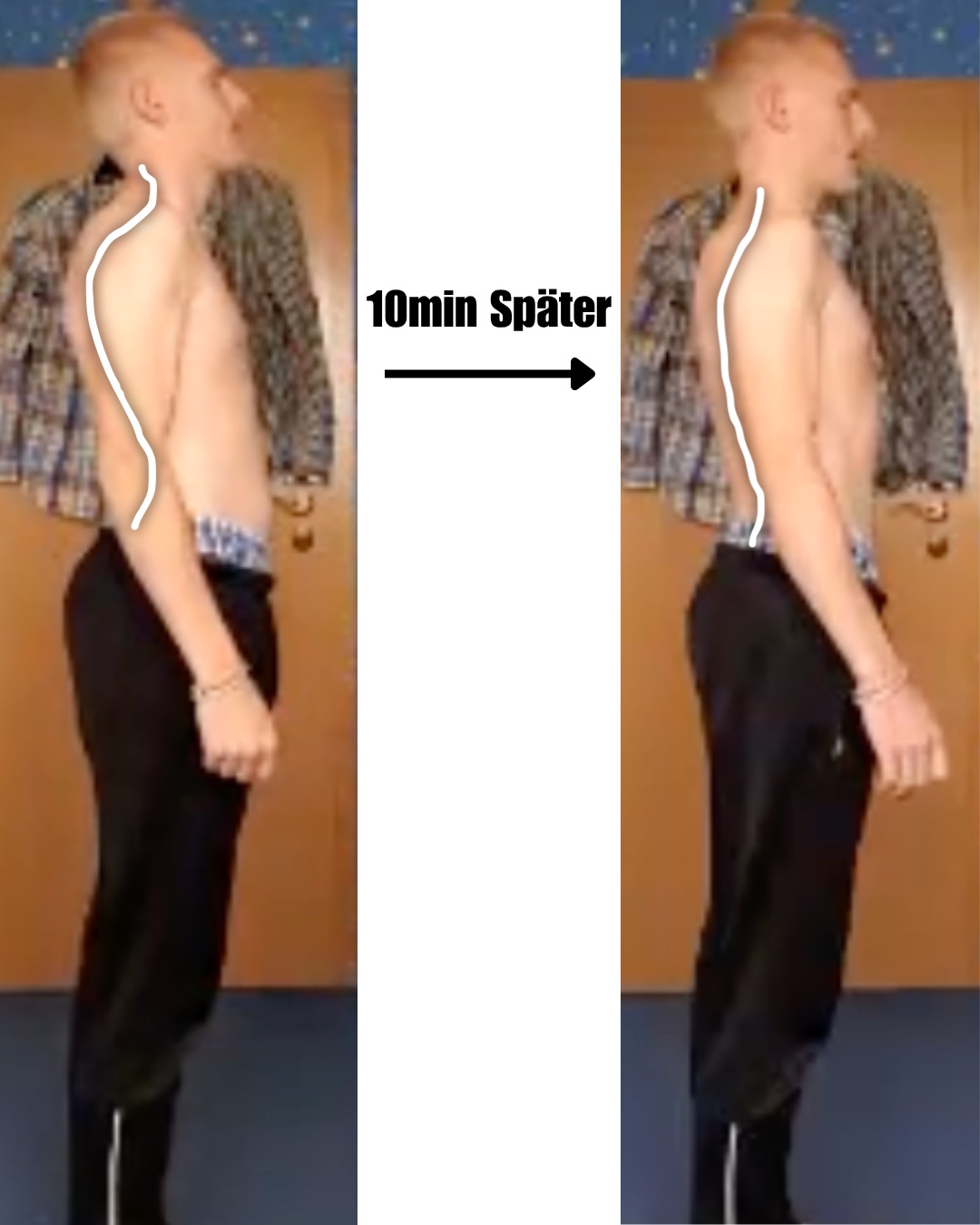 Timo H. – Vorher / Nachher